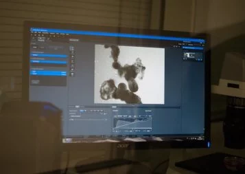 Toulouse. Deux nouvelles start-up très en pointe sur la peau et les cellules souches rejoignent l'Oncopole